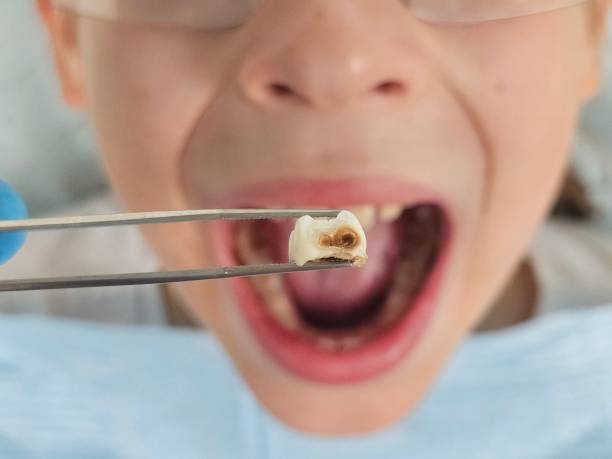 Emergency Dentist for Kids in LA